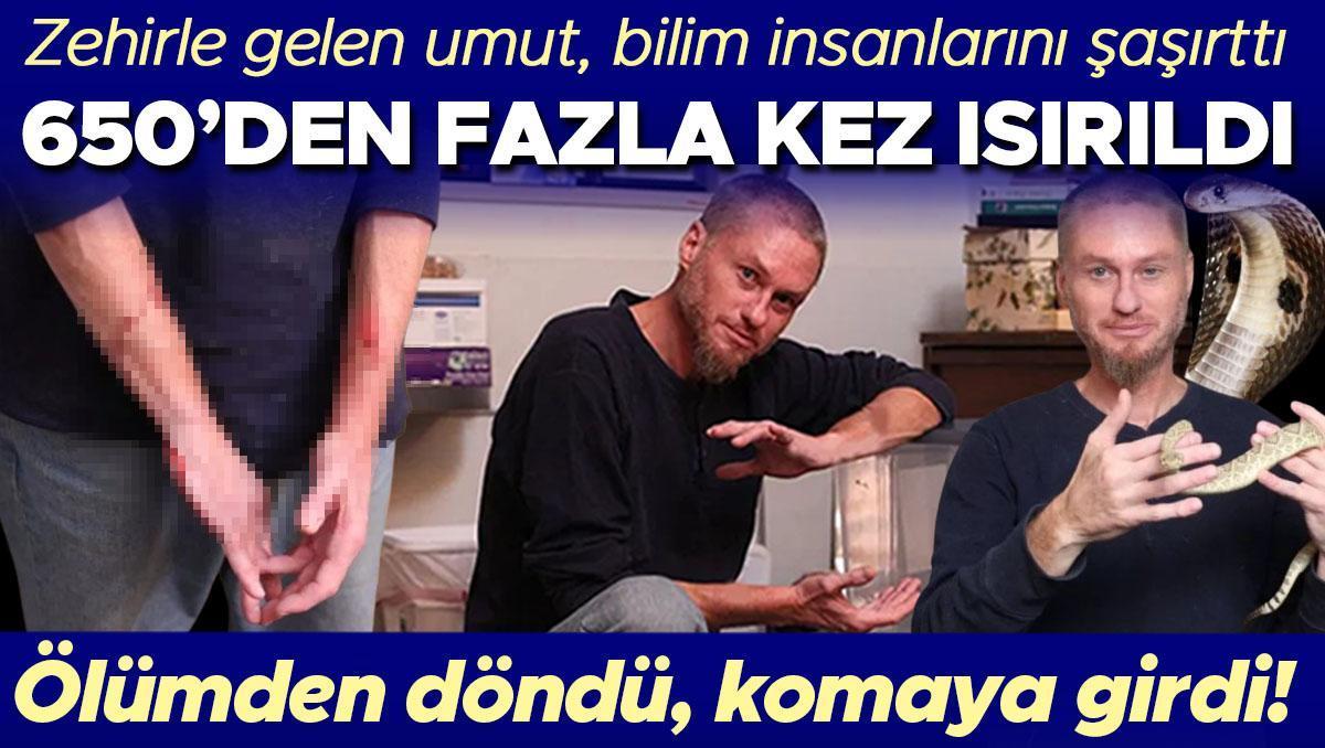 Zehirle gelen umut! Bilim insanlarını şaşırttı, 650’den fazla kez ısırıldı! ‘Yıllardır bunu bekliyordum, harika bir duygu’